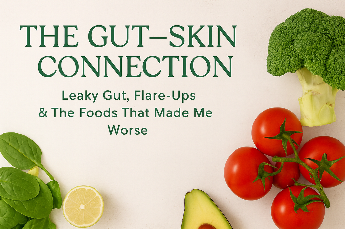 Leaky Gut, Flare-ups & The Foods That Made Me Worse (Part 2)